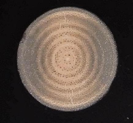 YAG Laser Spot on Burn Paper